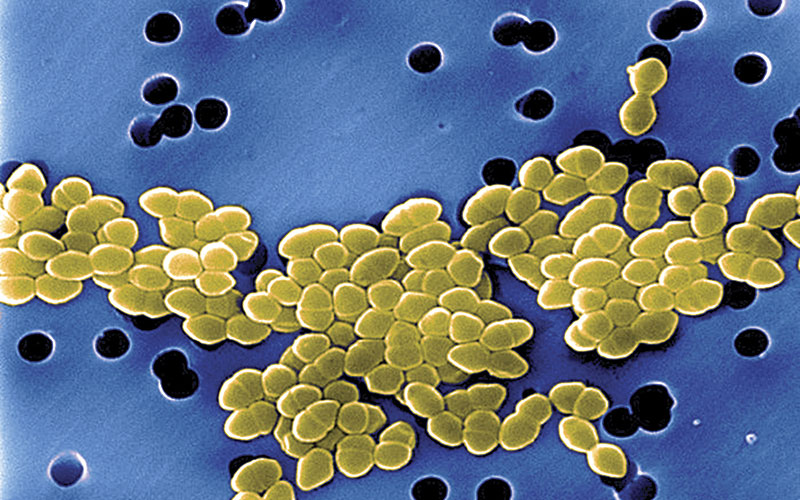 Vancomycin Resistant Enterococci Science