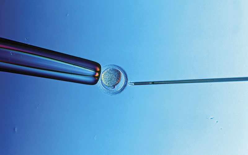 In Vitro Fertilisation Egg Injected with Sperm Science photo
