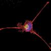 Triple negative breast cancer cell