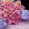 p8-13-news-car-t-cell-therapy-science-photo-library-c0388808.jpg