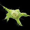 breast cancer cells - CREDIT - Science Photo Library-c0559159