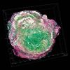 Breast cancer 3D tomography-CREDIT-Science-Photo-Library-c0303374