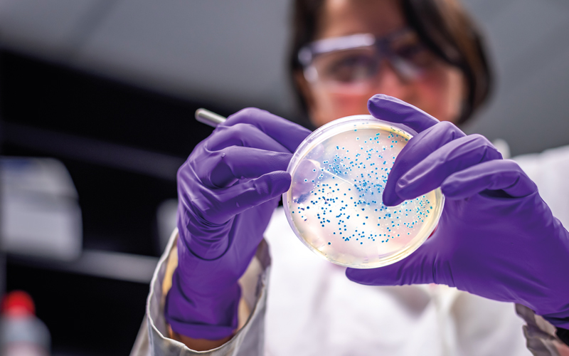 Woman researcher performing examination of bacterial culture plateCREDIT_istock-1131003688