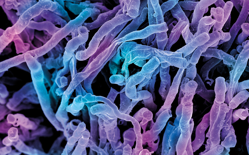 actinomyces viscosus bacteria CREDIT - science photolibrary
